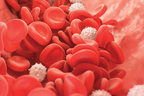 Curso superior de hematología para médicos